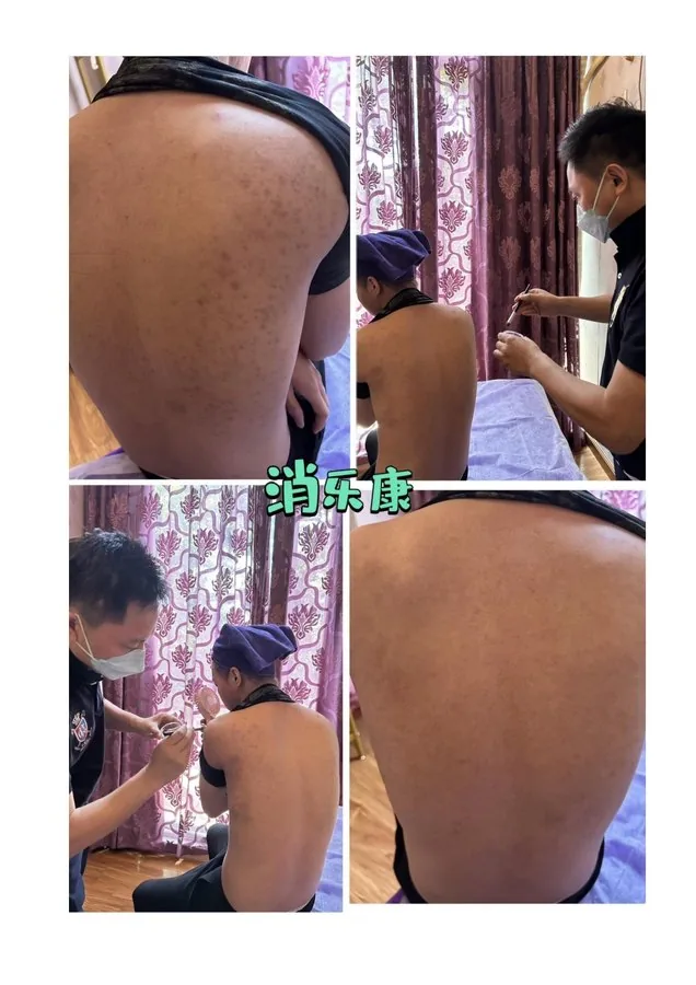 案例 05