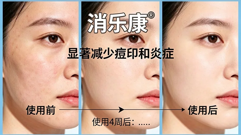 供货发货